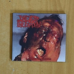 DEAD INFECTIONS - A CHAPTER OF ACCIDENTS - CD